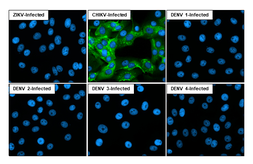 Anti-Chikungunya virus nsP3 antibody [HL2479] used in Immunocytochemistry/ Immunofluorescence (ICC/IF). GTX638828